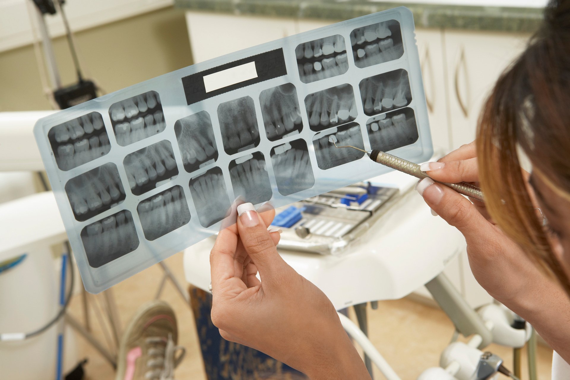 röntgen bilder tandvård